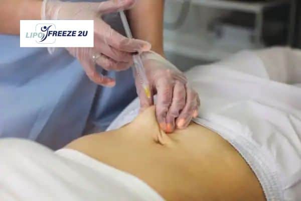 How Does Aqualyx Fat Dissolving Injection Work to Break Down Fat Ayr?