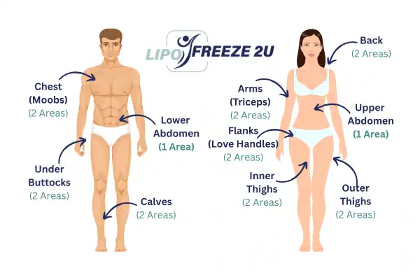 Areas you can have fat freezing treatment Ayr