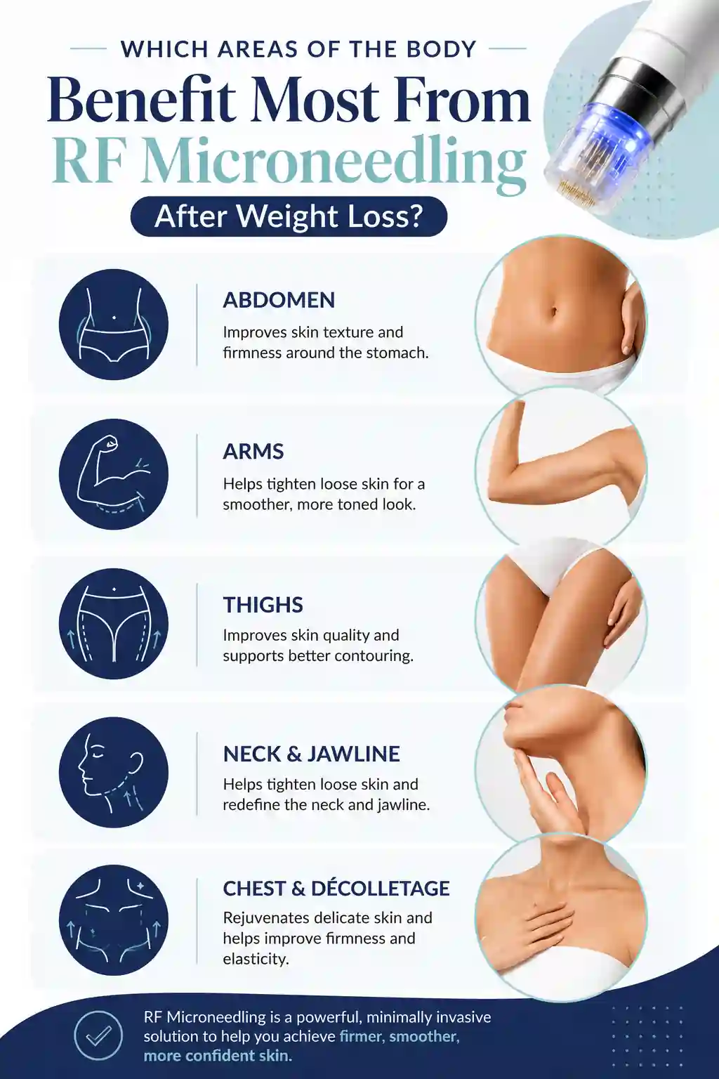 Which Areas of the Body Benefit Most From RF Microneedling After Weight Loss Ayr